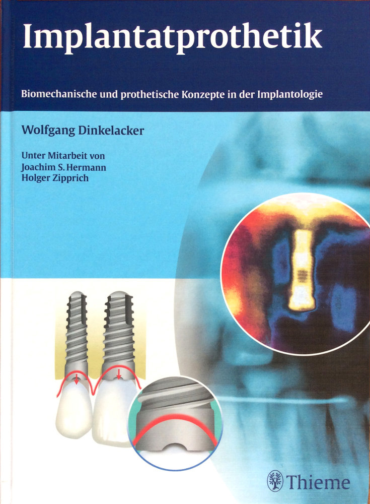 Fachbuch Implantatprothetik
